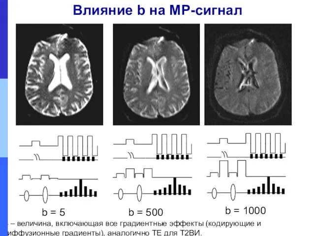 Влияние b на МР-сигнал B – величина, включающая все градиентные эффекты (кодирующие и