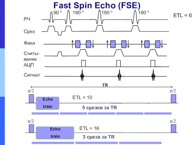 Fast Spin Echo (FSE) ETL = 6