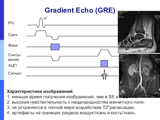 Gradient Echo (GRE) Характеристики изображений: 1. меньше время получения изображений,