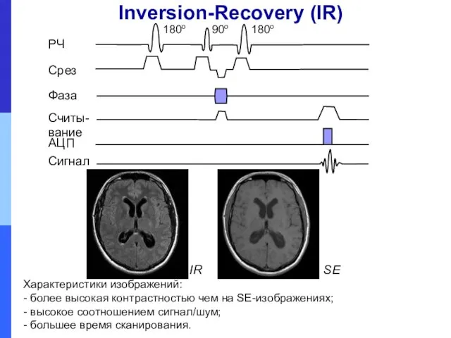 Inversion-Recovery (IR) Характеристики изображений: - более высокая контрастностью чем на SE-изображениях; - высокое