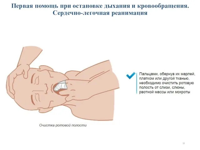 Первая помощь при остановке дыхания и кровообращения. Сердечно-легочная реанимация