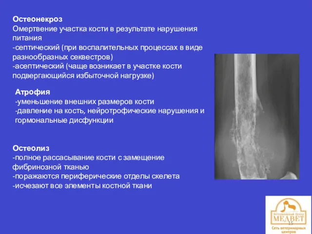 Остеонекроз Омертвение участка кости в результате нарушения питания -септический (при