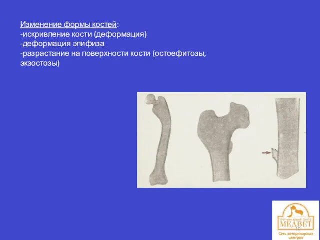 Изменение формы костей: -искривление кости (деформация) -деформация эпифиза -разрастание на поверхности кости (остоефитозы, экзостозы)