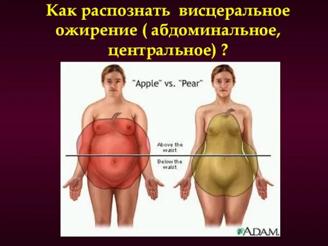 Как распознать висцеральное ожирение ( абдоминальное, центральное) ?