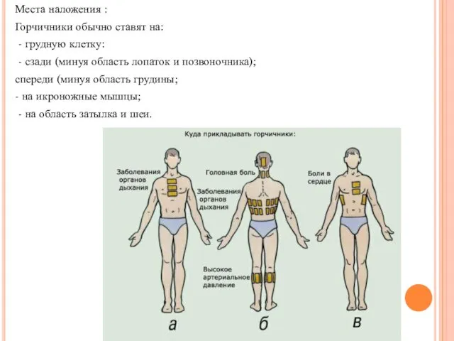 Места наложения : Горчичники обычно ставят на: - грудную клетку: