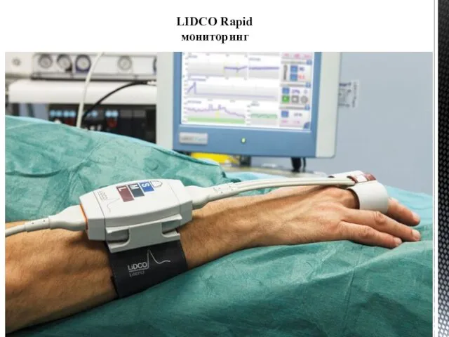 LIDCO Rapid мониторинг