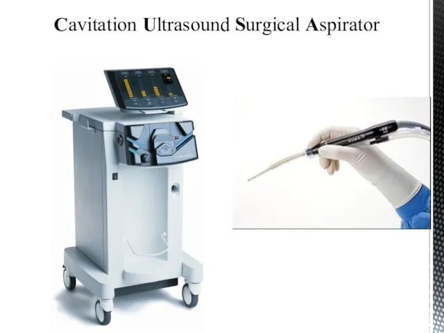 Cavitation Ultrasound Surgical Aspirator