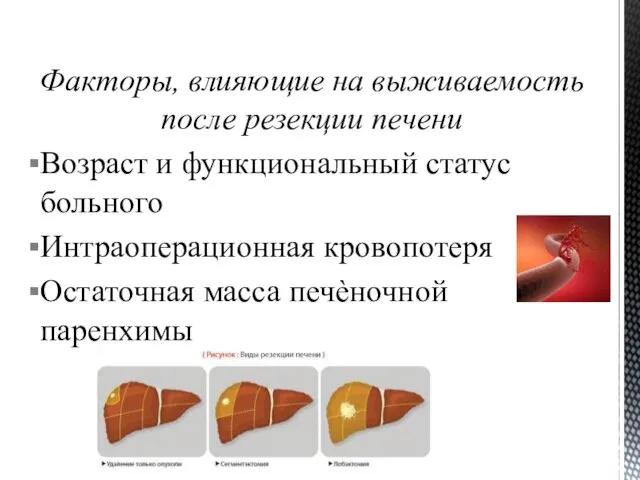 Факторы, влияющие на выживаемость после резекции печени Возраст и функциональный