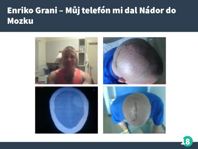 Enriko Grani – Můj telefón mi dal Nádor do Mozku