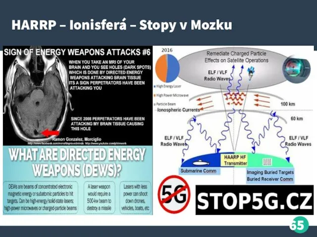 HARRP – Ionisferá – Stopy v Mozku