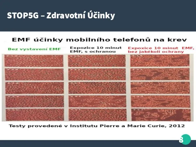 STOP5G – Zdravotní Účinky