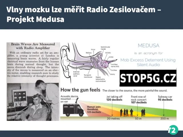 Vlny mozku lze měřit Radio Zesilovačem – Projekt Medusa