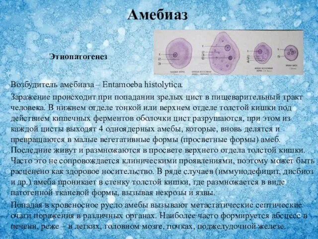 Возбудитель амебиаза – Entamoeba histolytica. Заражение происходит при попадании зрелых