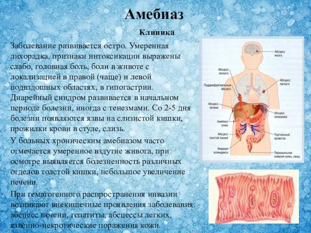 Заболевание развивается остро. Умеренная лихорадка, признаки интоксикации выражены слабо, головная