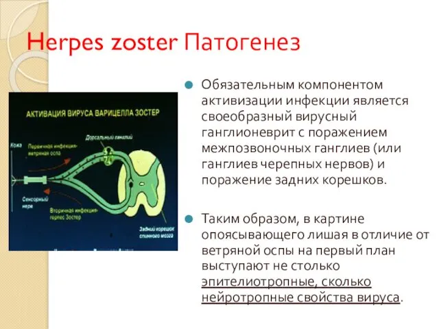 Herpes zoster Патогенез Обязательным компонентом активизации инфекции является своеобразный вирусный ганглионеврит с поражением