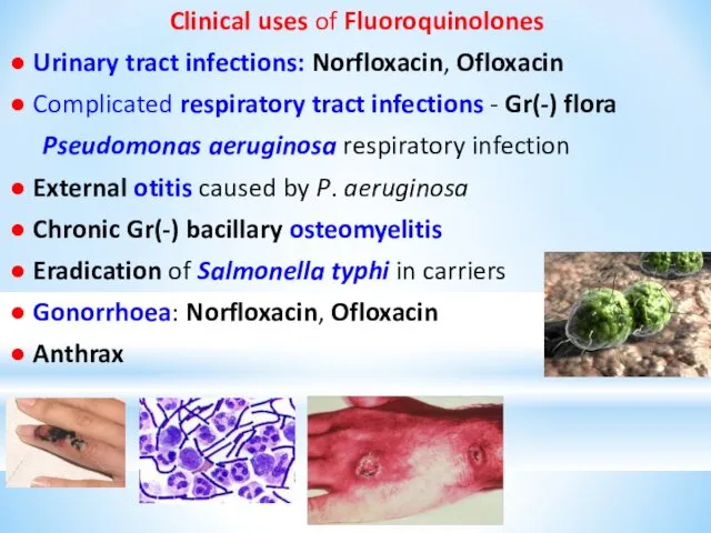 Clinical uses of Fluoroquinolones ● Urinary tract infections: Norfloxacin, Ofloxacin