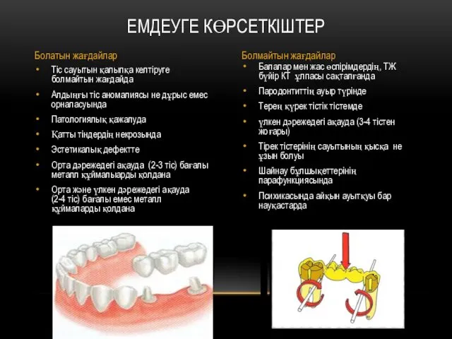 Балалар мен жас өспірімдердің, ТЖ бүйір КТ ұлпасы сақталғанда Пародонтиттің