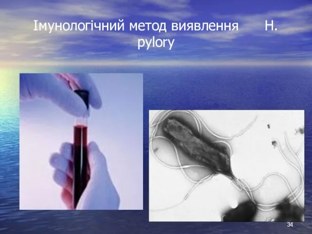 Імунологічний метод виявлення H. pylory