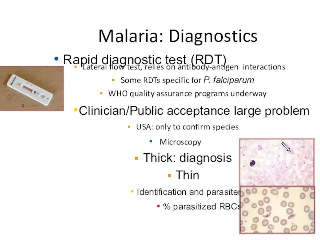 Malaria: Diagnostics Lateral flow test, relies on antibody-antigen interactions Some