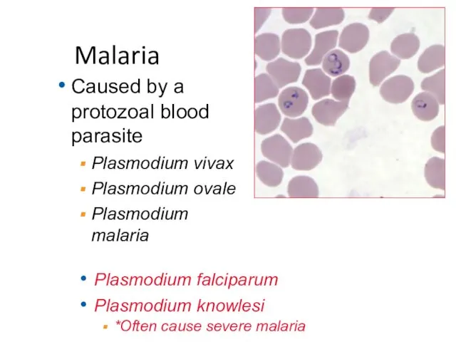 Malaria Caused by a protozoal blood parasite Plasmodium vivax Plasmodium