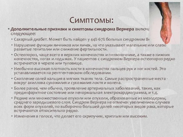 Симптомы: Дополнительные признаки и симптомы синдрома Вернера включают следующее: Сахарный