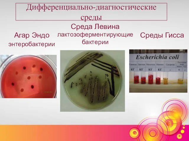 Дифференциально-диагностические среды Агар Эндо энтеробактерии Среда Левина лактозоферментирующие бактерии Среды Гисса