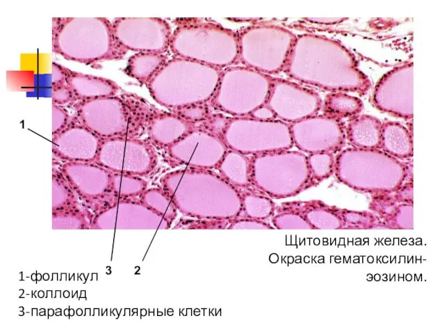 1-фолликул 2-коллоид 3-парафолликулярные клетки Щитовидная железа. Окраска гематоксилин-эозином. 1 3 2