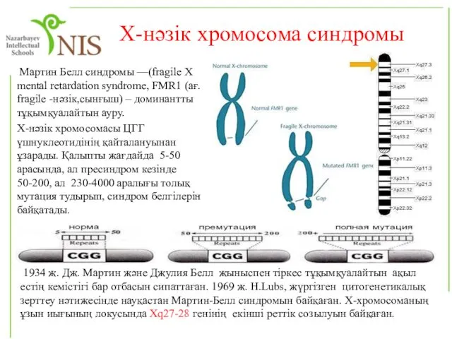 Х-нәзік хромосома синдромы Мартин Белл синдромы —(fragile X mental retardation