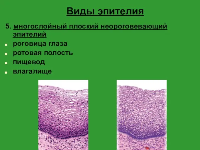 Виды эпителия 5. многослойный плоский неороговевающий эпителий роговица глаза ротовая полость пищевод влагалище