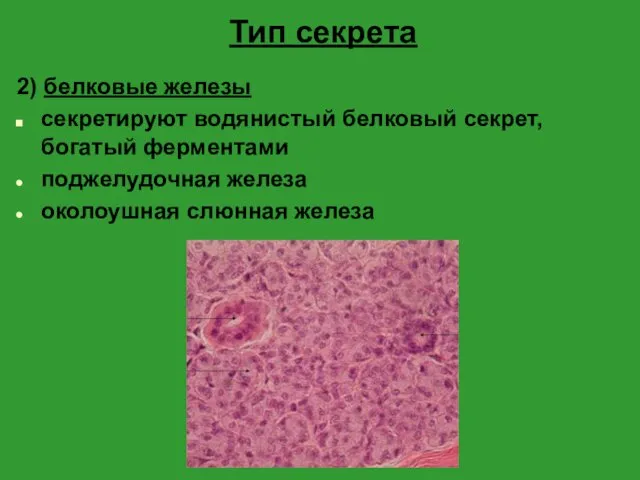 Тип секрета 2) белковые железы секретируют водянистый белковый секрет, богатый ферментами поджелудочная железа околоушная слюнная железа