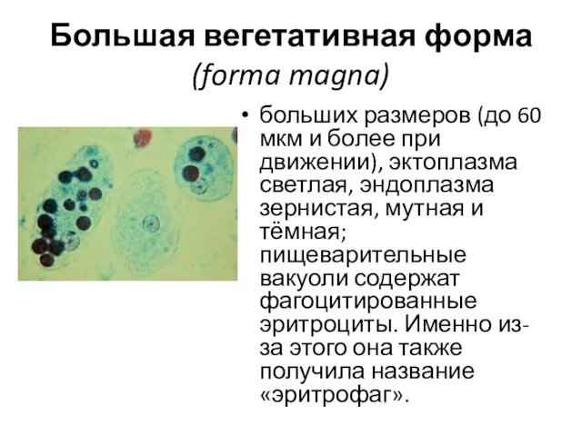 Большая вегетативная форма (forma magna) больших размеров (до 60 мкм