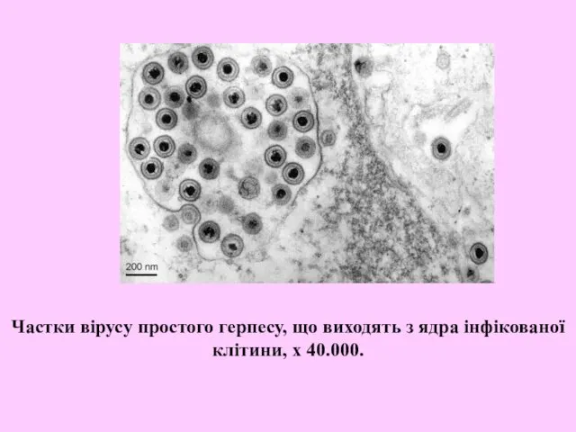 Частки вірусу простого герпесу, що виходять з ядра інфікованої клітини, x 40.000.