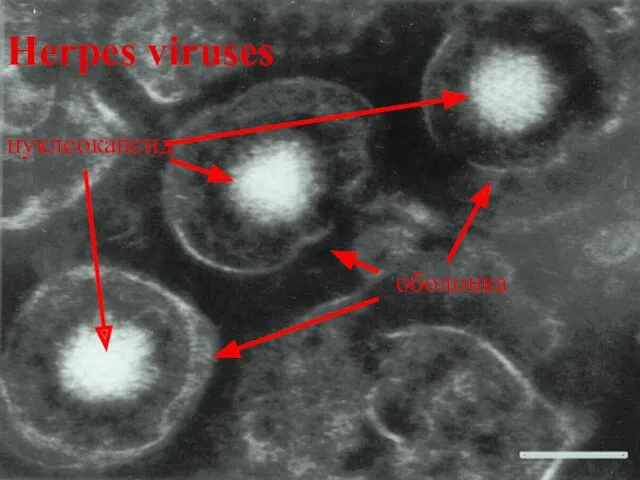 Herpes viruses оболонка нуклеокапсид
