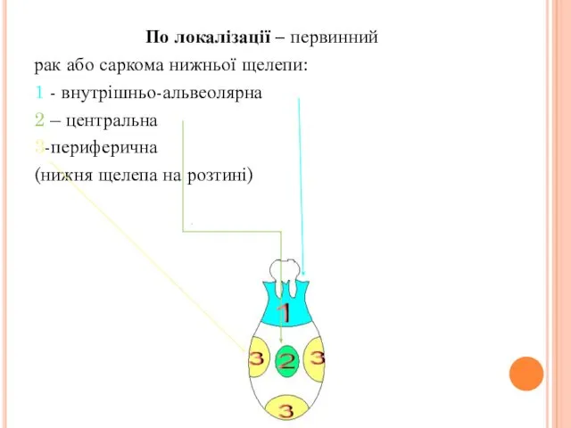 По локалізації – первинний рак або саркома нижньої щелепи: 1