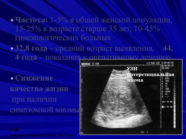 Частота: 1-5% в общей женской популяции, 15-25% в возрасте старше