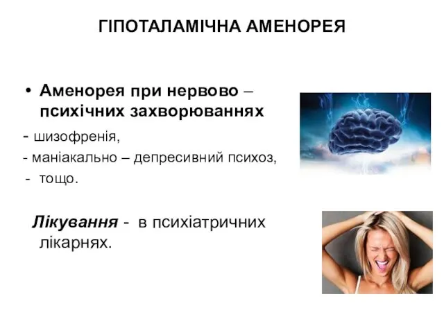 ГІПОТАЛАМІЧНА АМЕНОРЕЯ Аменорея при нервово – психічних захворюваннях - шизофренія,