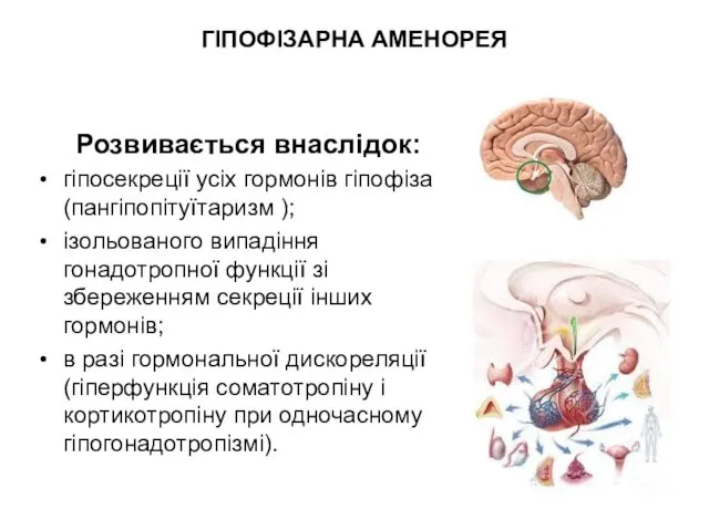 ГІПОФІЗАРНА АМЕНОРЕЯ Розвивається внаслідок: гіпосекреції усіх гормонів гіпофіза (пангіпопітуїтаризм );