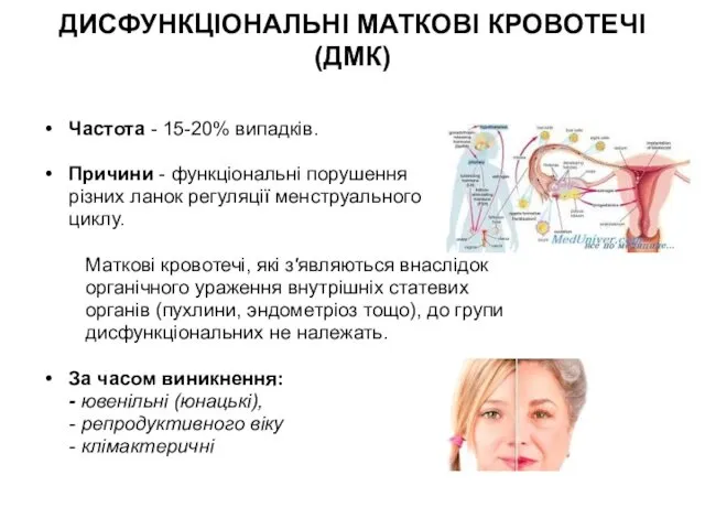 ДИСФУНКЦІОНАЛЬНІ МАТКОВІ КРОВОТЕЧІ (ДМК) Частота - 15-20% випадків. Причини -