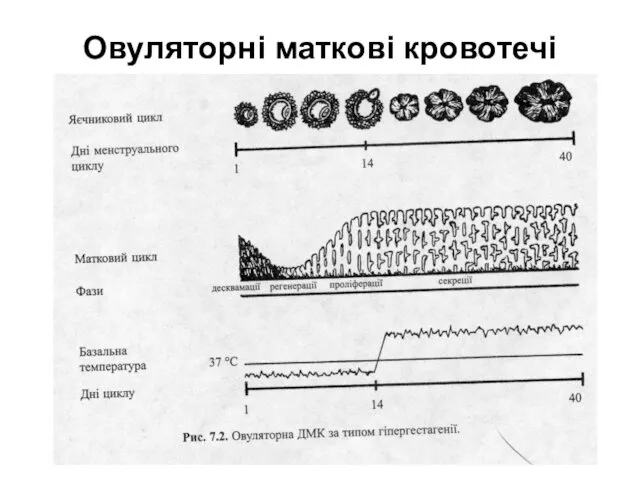 Овуляторні маткові кровотечі