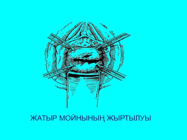 ЖАТЫР МОЙНЫНЫҢ ЖЫРТЫЛУЫ