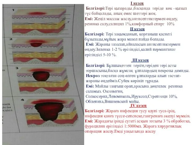 I кезең Белгілері:Тері қызарады ,басқанда теріде көк –қызыл түс байқалады,