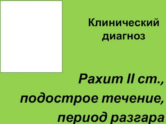 Клинический диагноз Рахит ІІ ст., подострое течение, период разгара