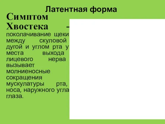 Латентная форма Симптом Хвостека - поколачивание щеки между скуловой дугой