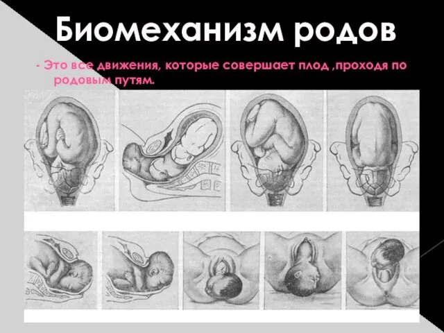 Биомеханизм родов - Это все движения, которые совершает плод ,проходя по родовым путям.