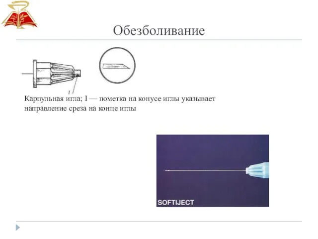 Обезболивание Карпульная игла; I — пометка на конусе иглы указывает направление среза на конце иглы