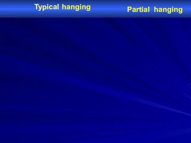 Typical hanging Partial hanging