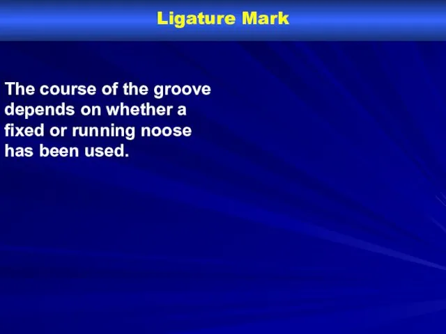 Ligature Mark The course of the groove depends on whether