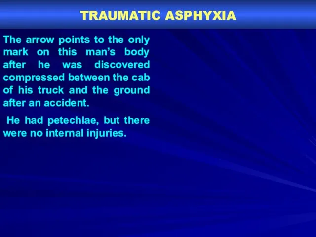TRAUMATIC ASPHYXIA The arrow points to the only mark on