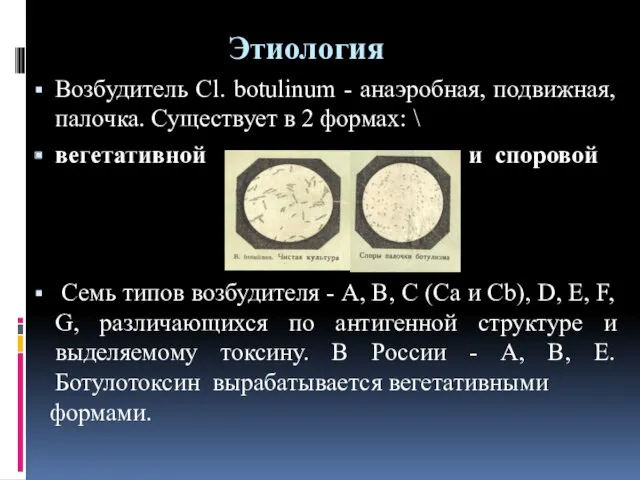 Этиология Возбудитель Cl. botulinum - анаэробная, подвижная, палочка. Существует в