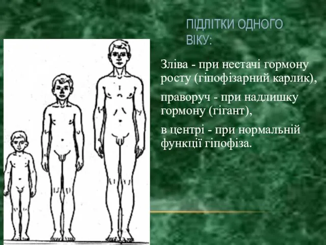 ПІДЛІТКИ ОДНОГО ВІКУ: Зліва - при нестачі гормону росту (гіпофізарний